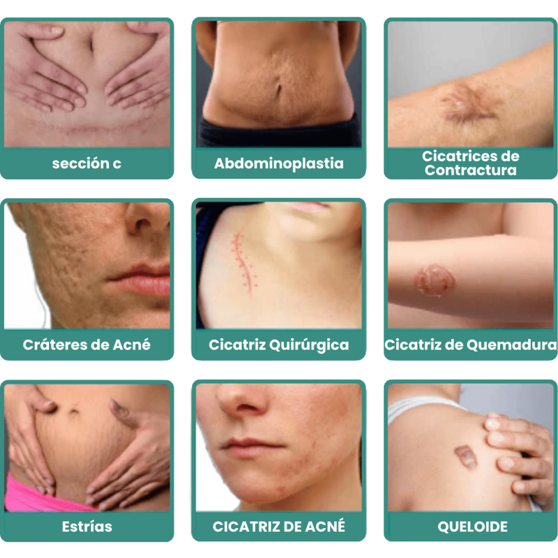 CicatriPlus | Restaurador de Pele