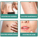 CicatriPlus | Restaurador de Pele