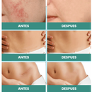CicatriPlus | Restaurador de Pele