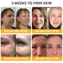 BeeLift Creme Firmador