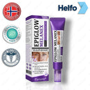 MelanEX Creme Anti-Hiperpigmentação