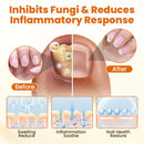 FungiBee Spray reparador de Unhas