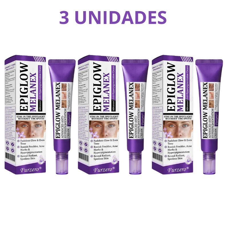 MelanEX Creme Anti-Hiperpigmentação