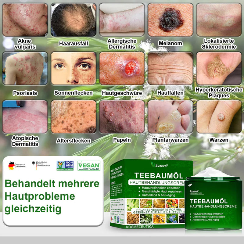 Teebaumol Cream