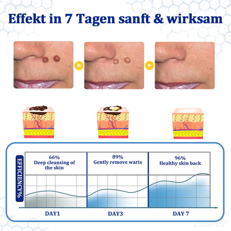 BeeDerm Cream