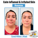 Venom Essense | Firmador de Pele