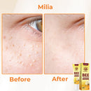 Dobshow™ Collagen+ Bee Venom - Creme diário para os olhos