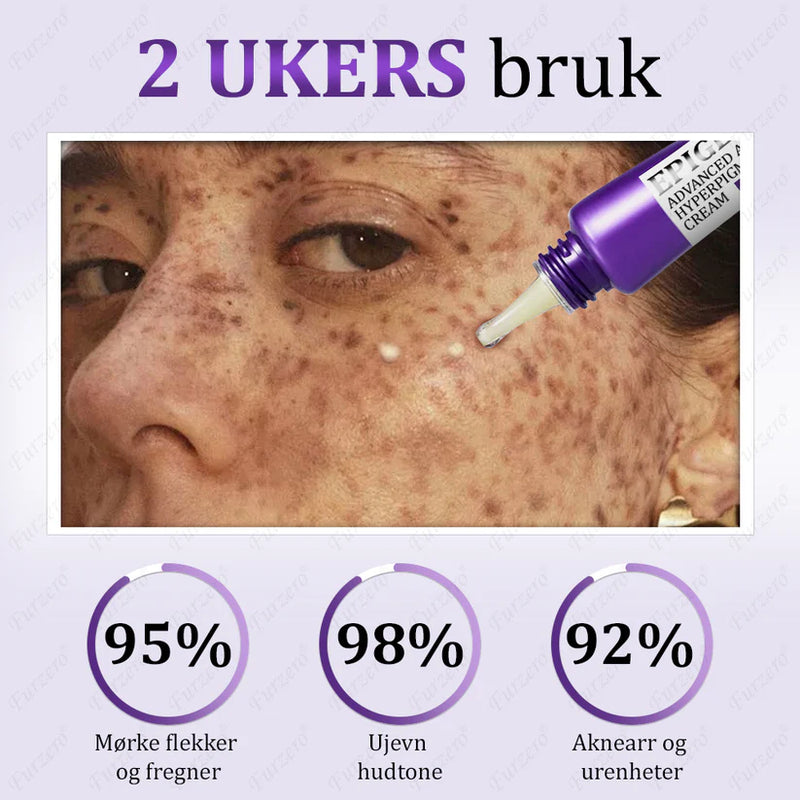 MelanEX Creme Anti-Hiperpigmentação