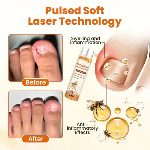FungiBee Spray reparador de Unhas