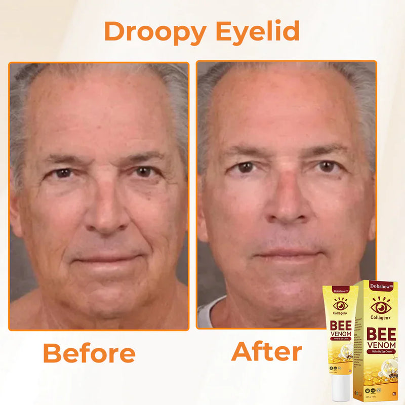 Dobshow™ Collagen+ Bee Venom - Creme diário para os olhos