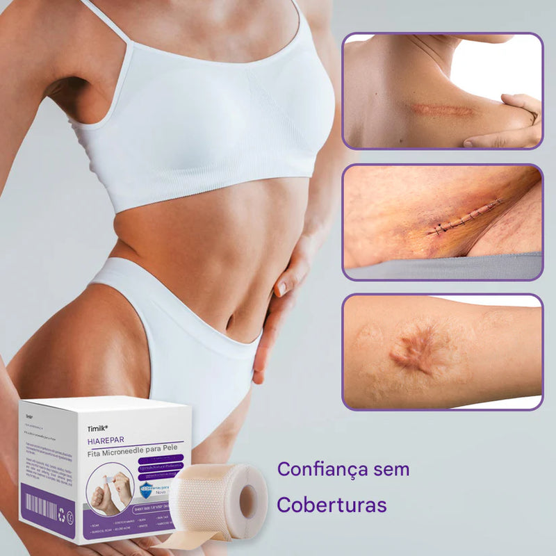 Fita de microagulhas HyaRepair