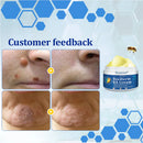 BeeDerm Cream