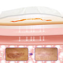 Fita de microagulhas HyaRepair