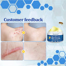 BeeDerm Cream