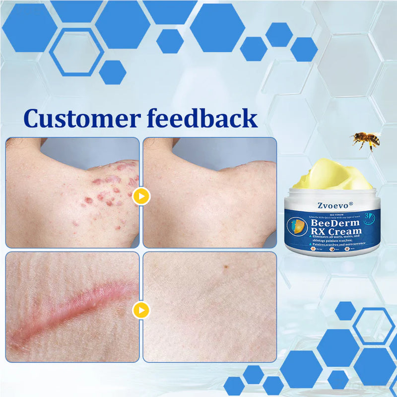 BeeDerm Cream