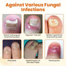 FungiBee Spray reparador de Unhas