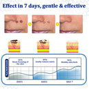 BeeDerm RX Removedor de Verrugas e Manchas