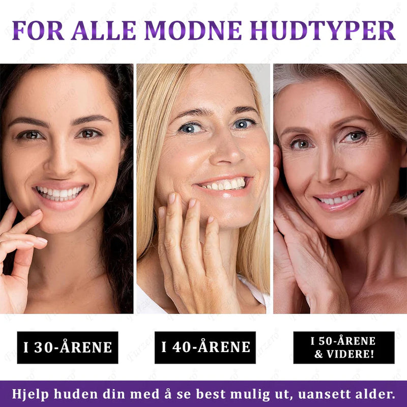 MelanEX Creme Anti-Hiperpigmentação