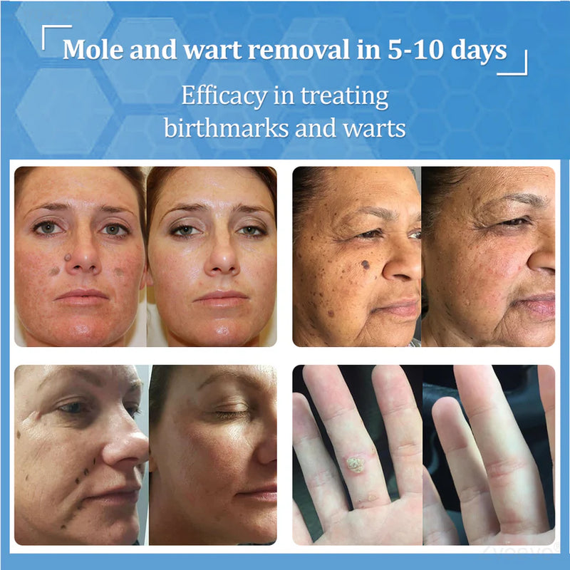 BeeDerm Cream