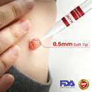 MoleGone Removedor de marcas, pintas e verrugas