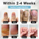 Caneta de soro de recuperação de Unhas ATTDX® MycoStop