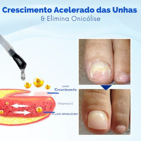 NailVita Pro
