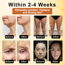 Bo-toxBee Firmador Multiação