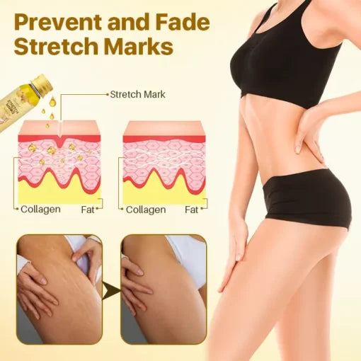 Stretch Óleo