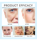 Hoygi Cream | Firmador de Pele