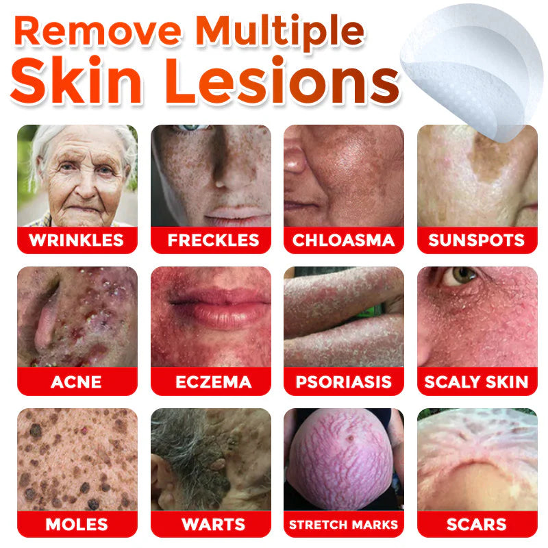 Microneedle