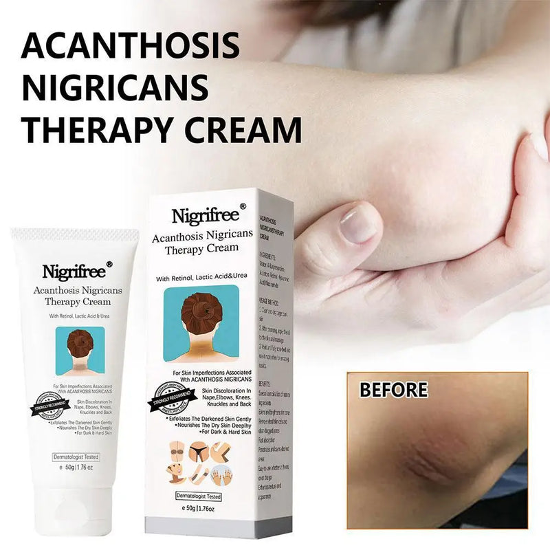 Creme Terapêutico DarkSpot Eraser