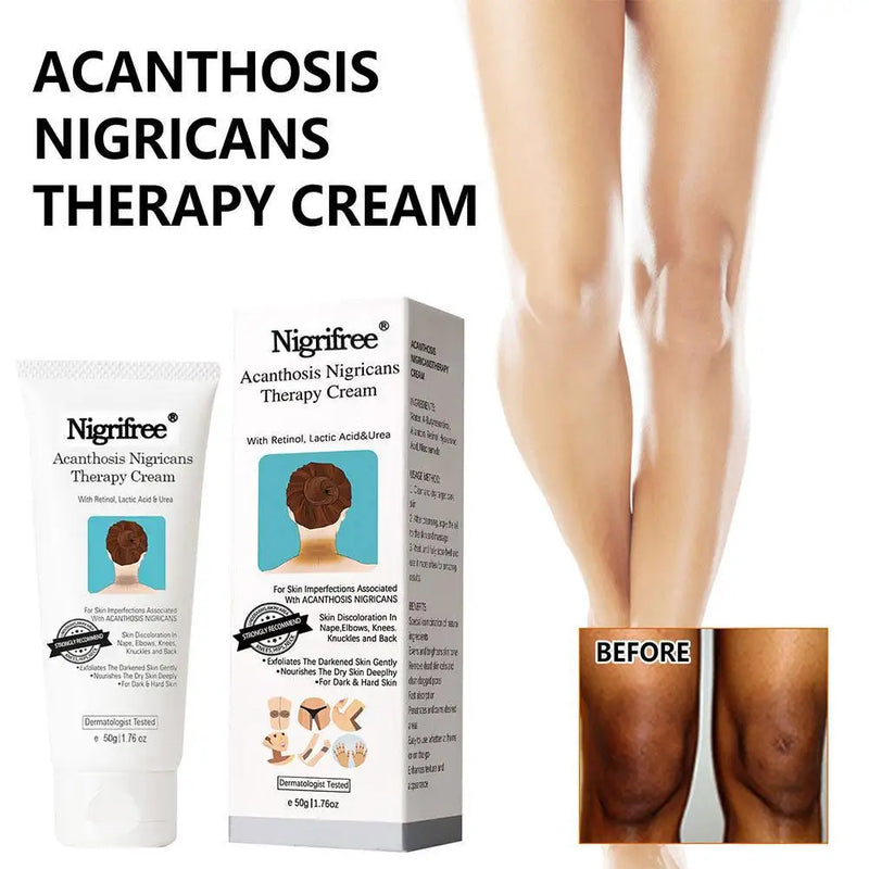 Creme Terapêutico DarkSpot Eraser