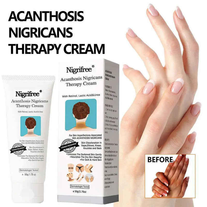 Creme Terapêutico DarkSpot Eraser