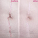 DermaSil | Restaurador de Pele