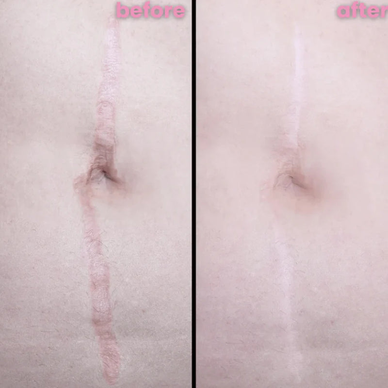 DermaSil | Restaurador de Pele