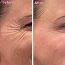 DermaSil | Restaurador de Pele