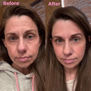 DermaSil | Restaurador de Pele