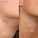 DermaSil | Restaurador de Pele