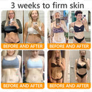 Royal Venom Cream | Firmador de Pele