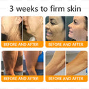 Royal Venom Cream | Firmador de Pele