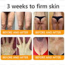 Royal Venom Cream | Firmador de Pele